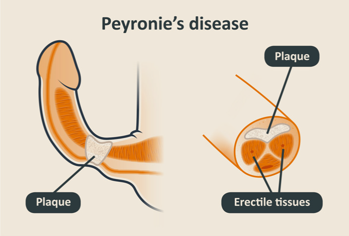 SOBI-pic-for-website