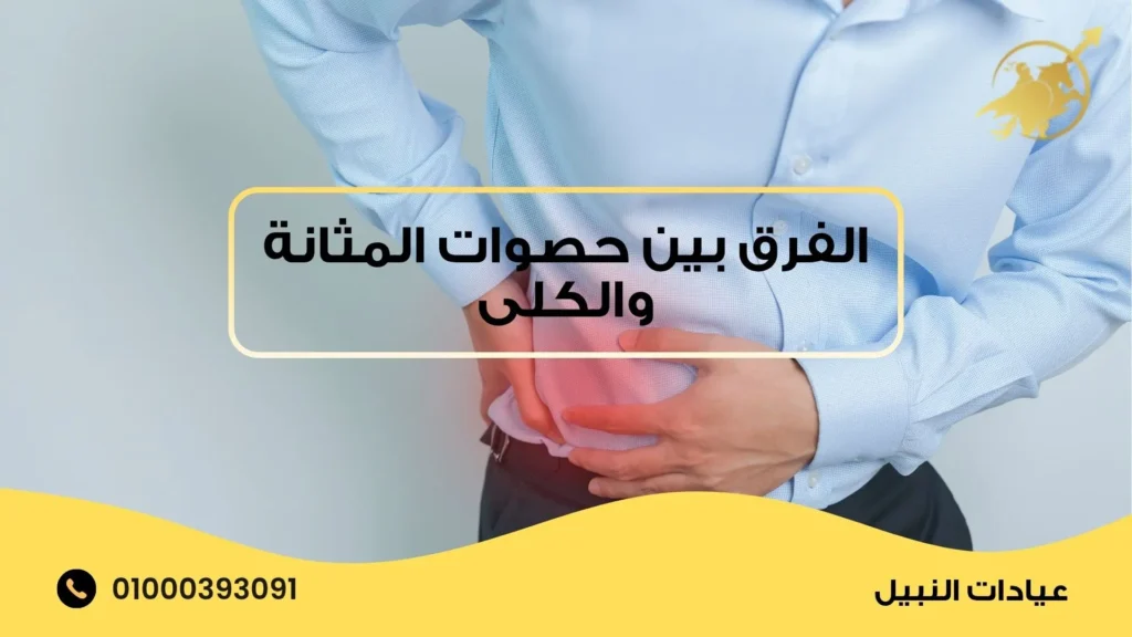 الفرق بين حصوات المثانة والكلى